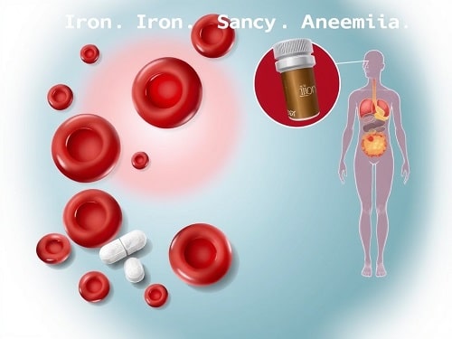 فقر الدم الناجم عن نقص الحديد